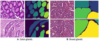 Multi-Organ Gland Segmentation Using Deep Learning